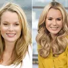 Artis Hollywood Operasi Plastik