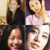 seleb korea memperbaiki gigi