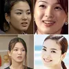 seleb korea memperbaiki gigi