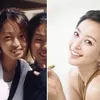 seleb korea memperbaiki gigi