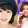 seleb korea perbaiki gigi