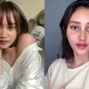 Potret Permesta Dhyaz Anak Farida Nurhan Sebelum dan Sesudah Oplas Hidung di Thailand