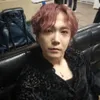 Lee Hong Ki FT Island Idap Penyakit Kulit Langka