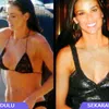 Selebritis dan Operasi Payudara