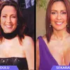 Selebritis dan Operasi Payudara