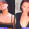 Selebritis dan Operasi Payudara