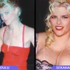 Selebritis dan Operasi Payudara