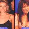 Selebritis dan Operasi Payudara