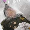 Kris Biantoro Meninggal