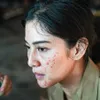 dian sastro jerawatan