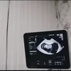 Asmirandah Keguguran