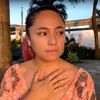 Marshanda idap tumor payudara