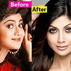 Tulang rahang dan bentuk bibir jelas berubah, tapi Shilpa Shetty bilang ini hanya efek make up. Oke deh...
