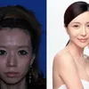 foto-foto operasi plastik di China