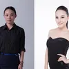 foto-foto operasi plastik di China