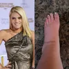 Hamil Anak Ketiga, Kaki Jessica Simpson Bengkak Parah