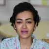 Banyak Teman Menjenguk, Kondisi Julia Perez Makin Membaik