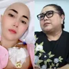 Termasuk Nunung, 4 Selebriti Tanah Air Ini Berjuang Melawan Kanker Payudara yang Menggerogoti Tubuh