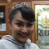 Yeyen Lidya & Ratna Listy Lakukan Operasi Kantung Mata, Tegaskan Bukan untuk Pasangan