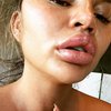 Weekly Hot IG: Foto Baby Bump Meghan Markle - Bibir Chrissy Teigen Bengkak Karena Kulit Jeruk