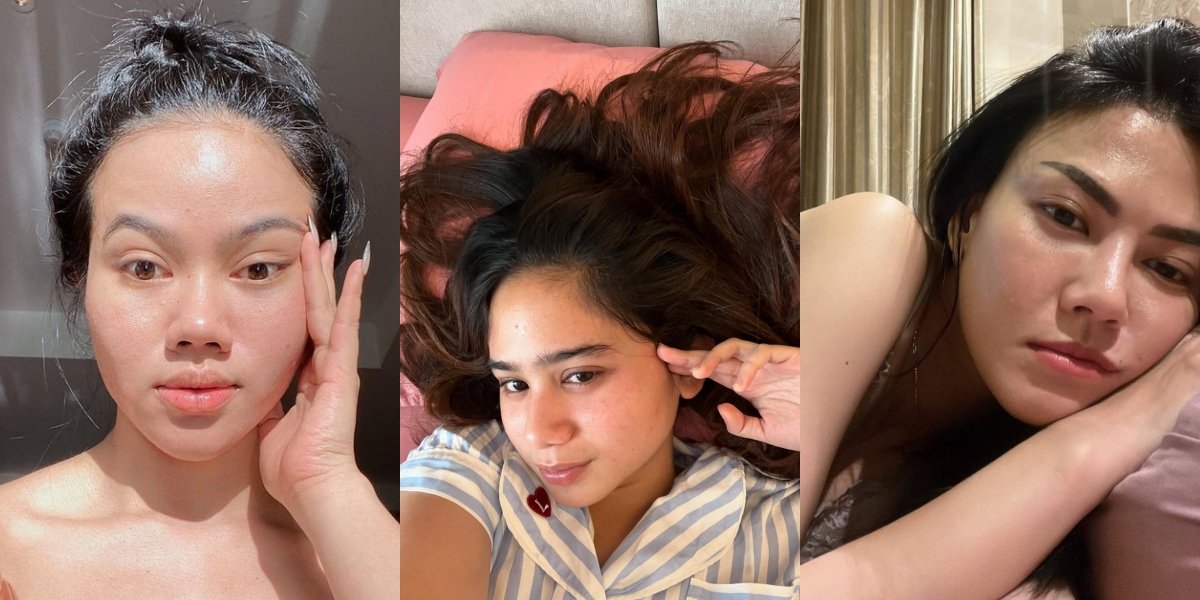 10 Portraits of Confident Artists Showing Off Their Bare Face, Still Charming Despite Oily and Acne-Prone Skin