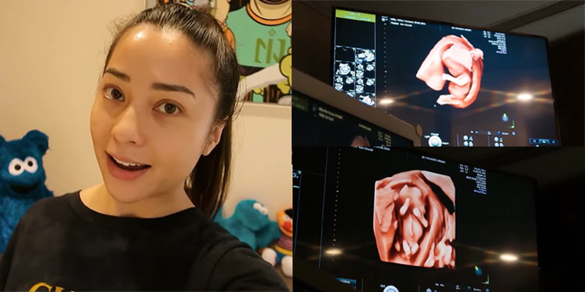 10 Portraits of Nikita Willy Undergoing Ultrasound, Fetus Becomes the Spotlight - Indra Priawan's Face Until Tense