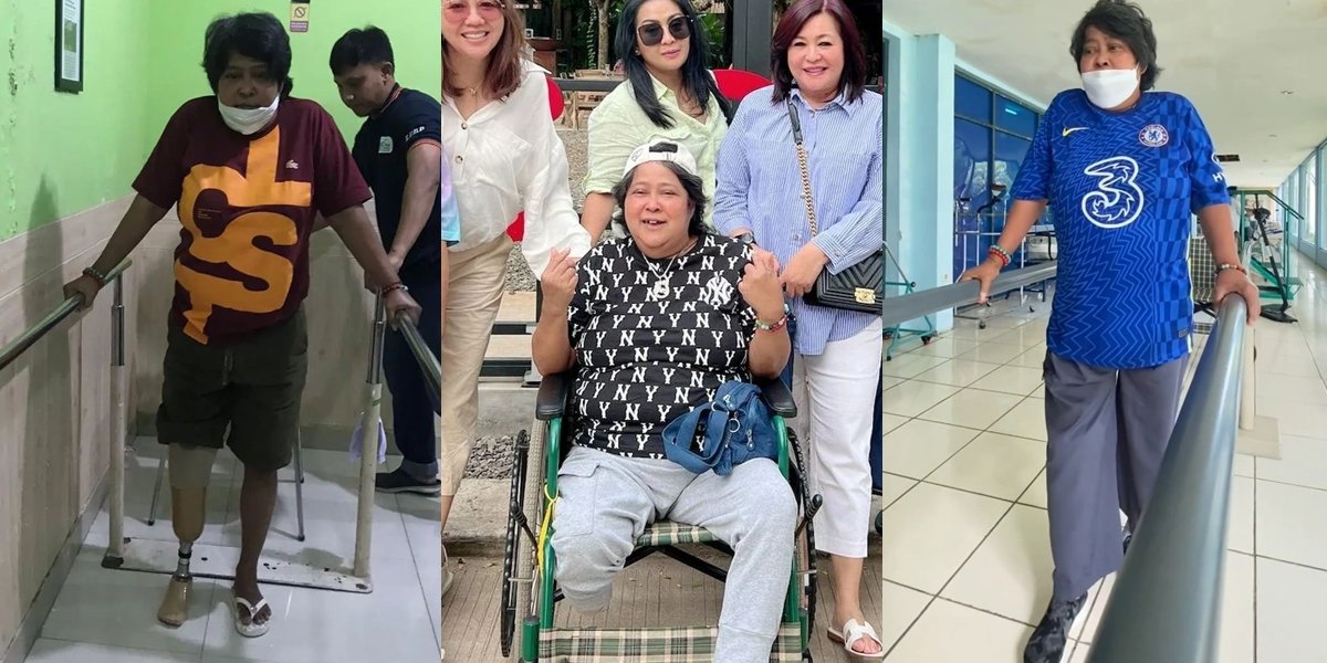 10 Portraits of Suti Karno After Amputation, Practicing Walking with Prosthetic Leg - Flood of Support from Friends