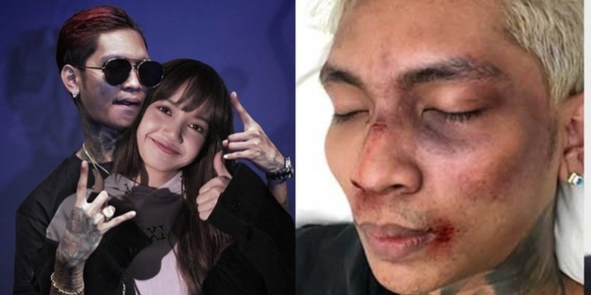 5 Controversies of Young Lex Condemned by K-Pop Fans, Insulting Lisa BLACKPINK - MV Plagiarism Lay EXO