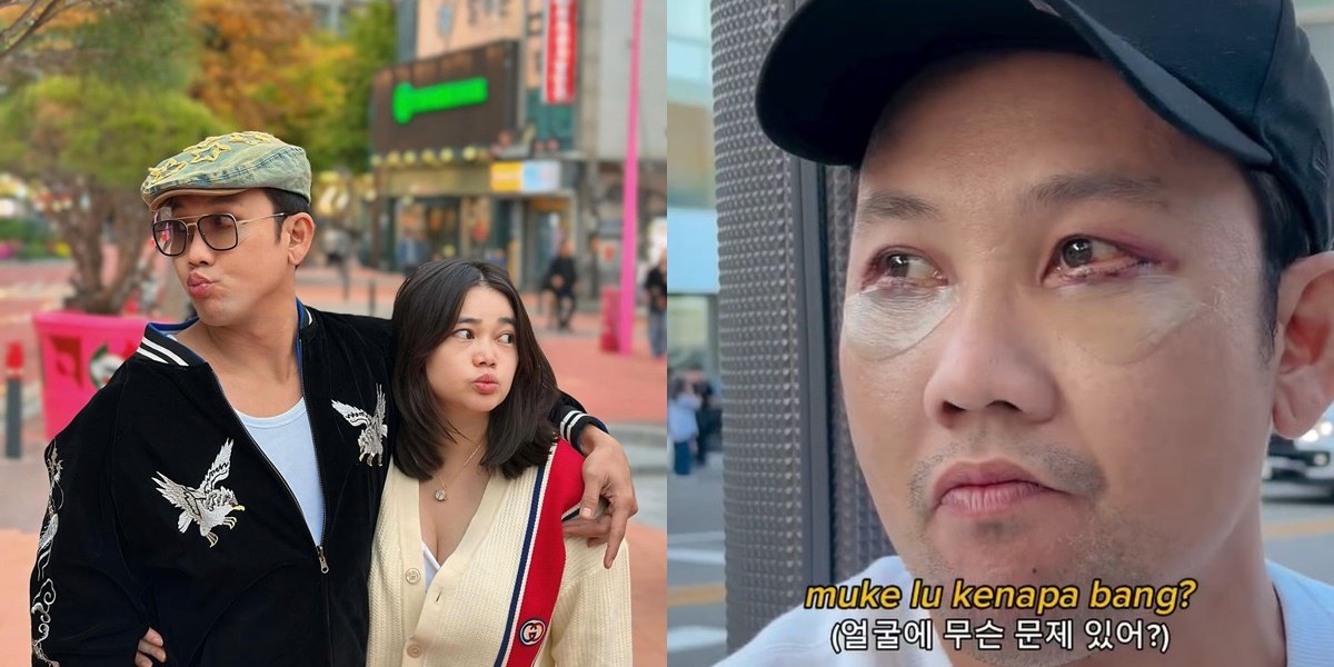 8 Portraits of Denny Sumargo Traveling in South Korea After Eyelid Surgery