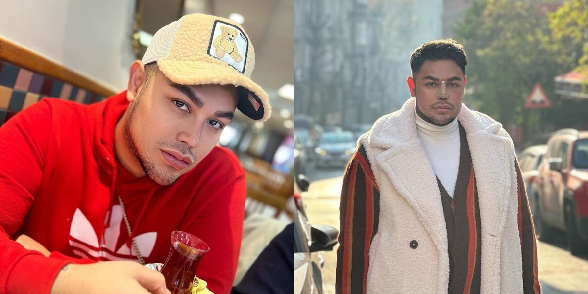 8 Portraits of Ivan Gunawan Post Nose Surgery in Turkey, Vacation and Celebrate Birthday - Still Bandaged Making Netizens Curious