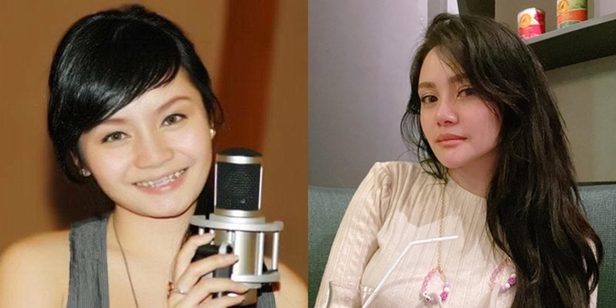 Admit to Plastic Surgery and Accused of White Injection, Here are 10 Photos of Mawar AFI's Transformation - Still Like a Teenager Despite Being 36 Years Old