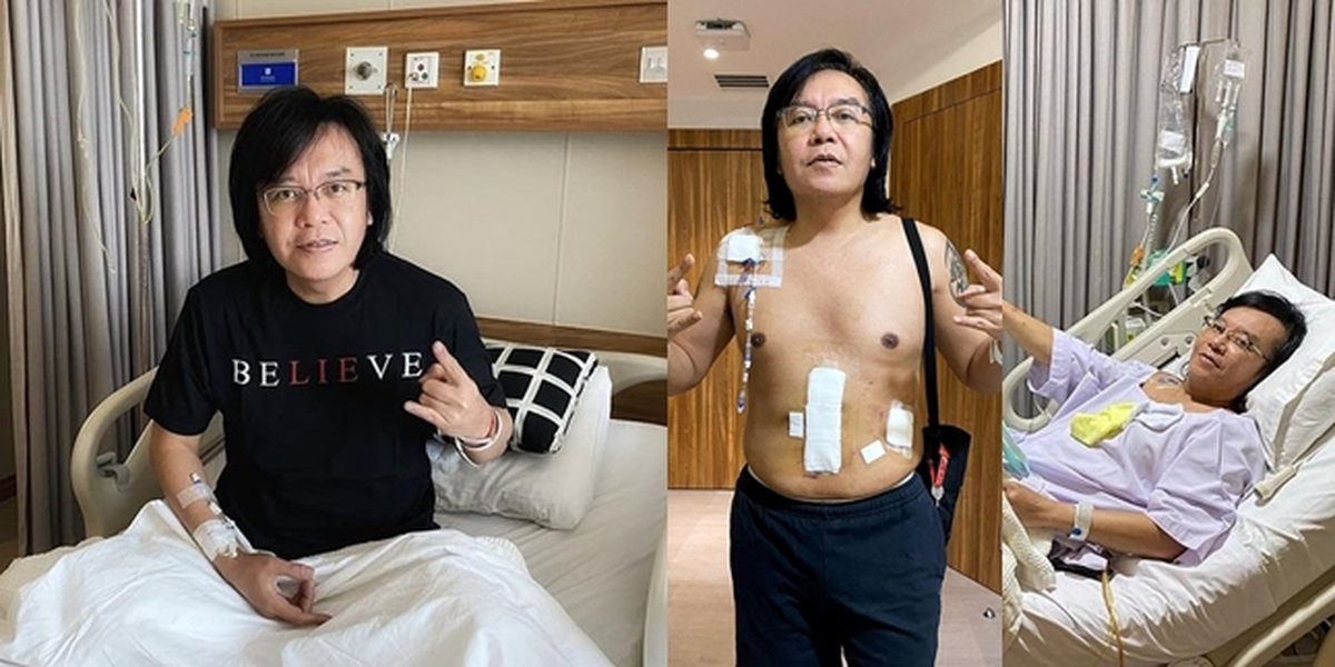 Ari Lasso Suffers from Rare Stage 2 Cancer, Here are the Pictures During Treatment - Will Undergo Chemotherapy and Cannot Meet People