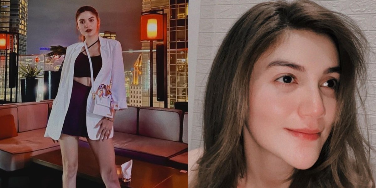 Making Netizens Worried, Portrait of Hilda Vitria, Former Billy Syahputra, Called Too Skinny - Sharp Cheeks Until Considered Plastic Surgery
