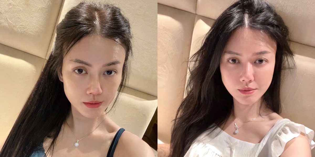 Nita Gunawan's Natural Beauty, Here are Confident Photos of Her Going Bare Face - Still Stunning Even with Oily Skin