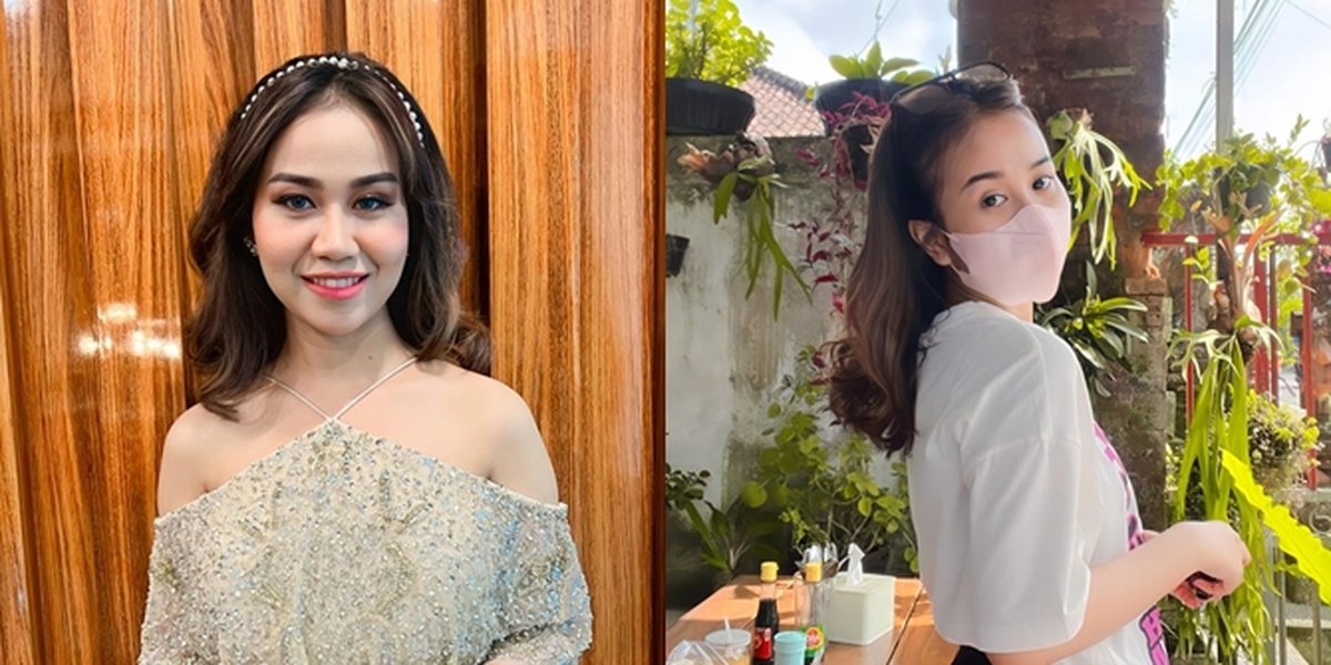 Receiving a Scholarship for Dental Medicine Faculty, Here are 7 Portraits of Mayang, the Late Vanessa Angel's Sister, Who Shines Even More - Will She Leave the Entertainment World?