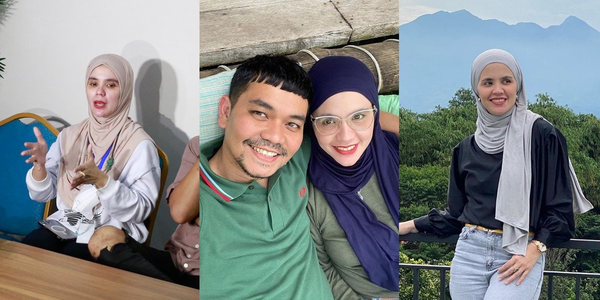 Criticized for Not Wanting to Lose Until Afraid of Poverty, 8 Portraits of Aldila Jelita Attacked by Netizens After Fundraising for Indra Bekti's Treatment