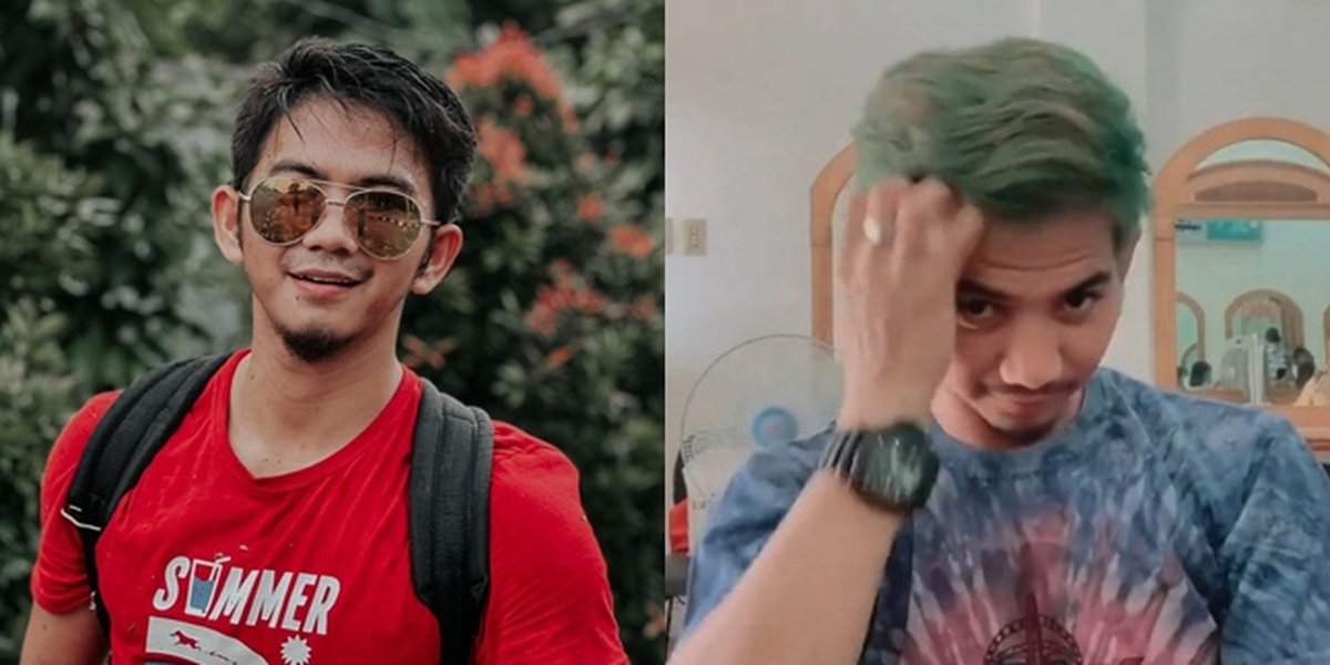 Reportedly Reconciled with Nadya Mustika Rahayu, 7 Photos of Rizki DA Changing Hair Color: So Funny!