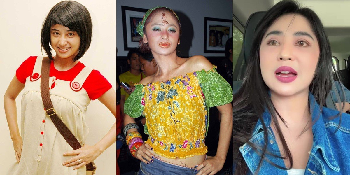 Known for Being Resilient, 8 Photos of Dewi Perssik's Transformation from Then Until Now Still Beautiful