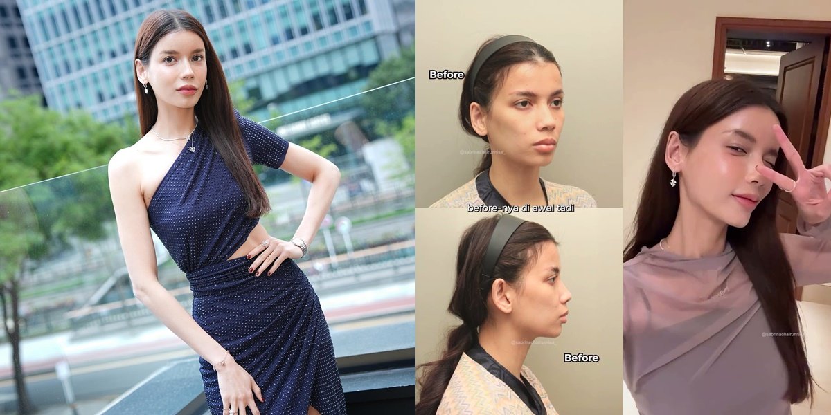 Thought to be plastic surgery, 8 Photos of Sabrina Chairunnisa Reveal the Secret Behind Her Slim and Sunken Face Now Being Fuller