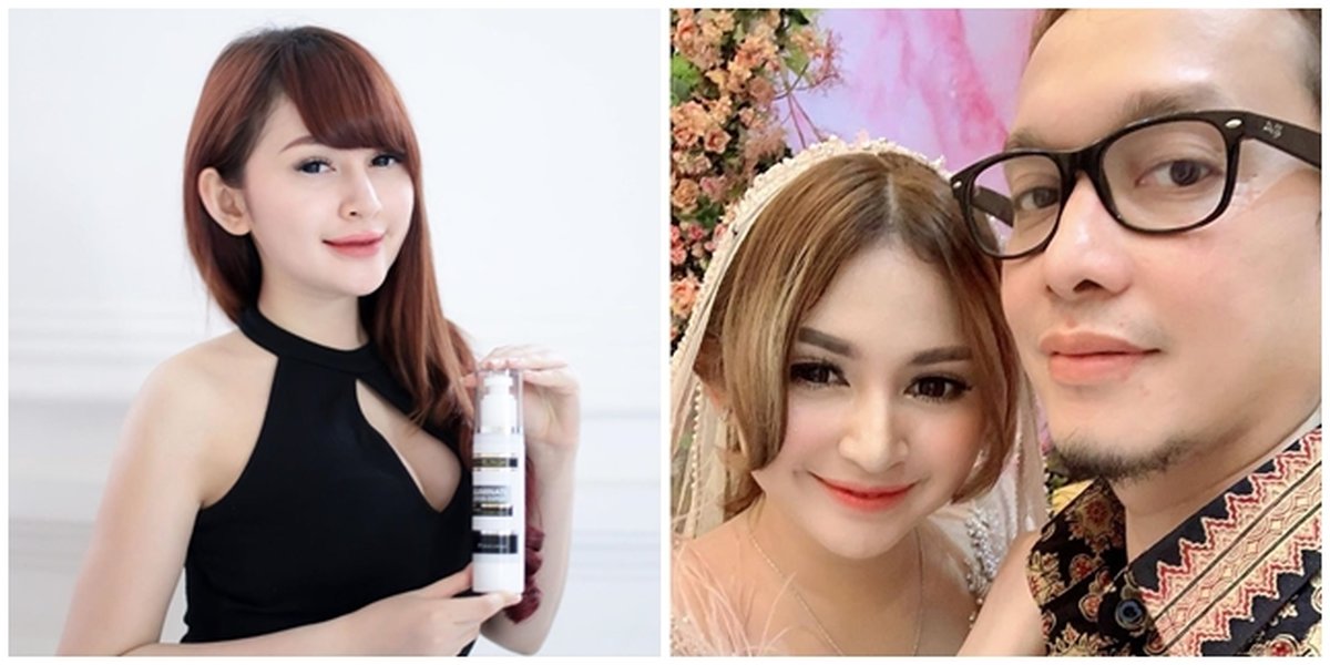 Accused of Being a Pelakor, Here are 10 Beautiful Photos of Selebgram 'Barbie' Winny Putri Lubis