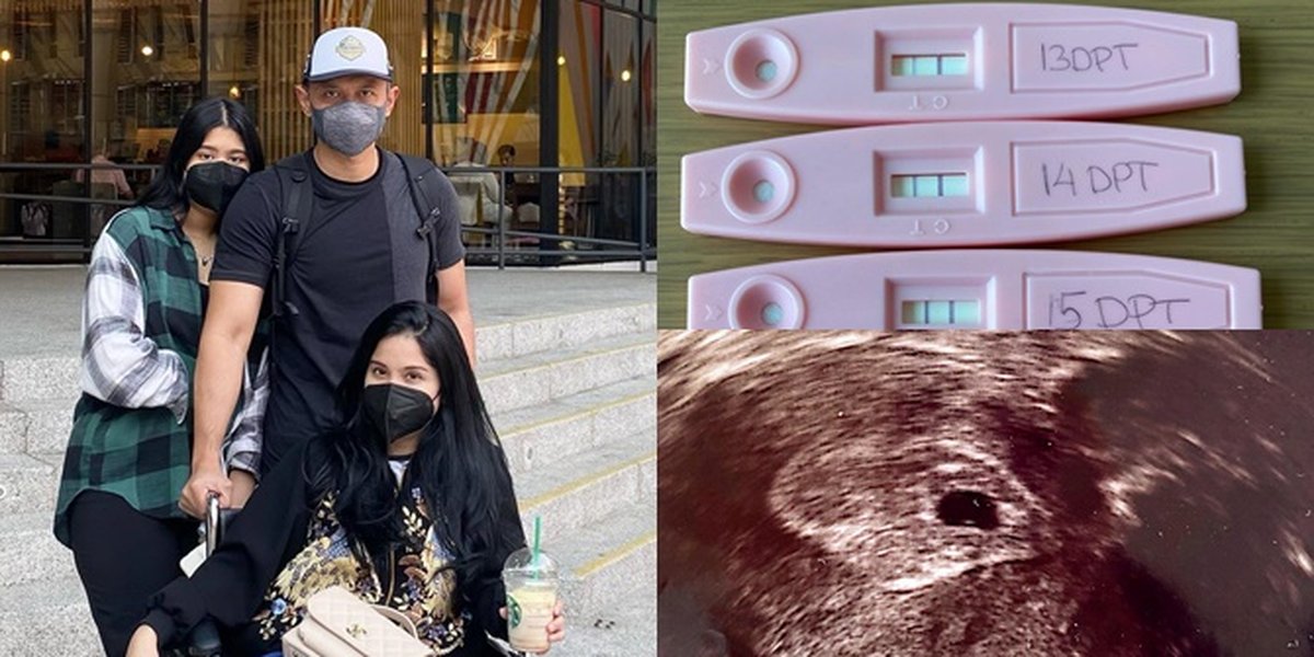 Annisa Yudhoyono's Recent Miscarriage, Fetus Did Not Develop at 7 Weeks and She Accepts It Despite Sadness