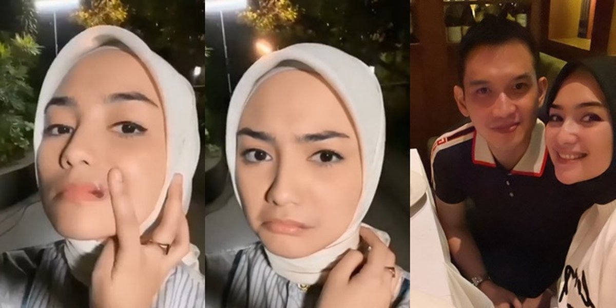 Citra Kirana's Lip Photo that Was Bruised Because of Being Hit by Wood by Her Son, Continues Shooting