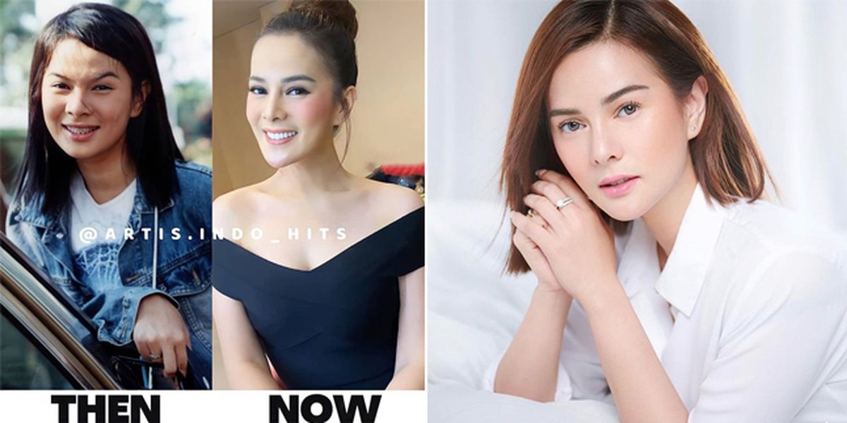 Viral Old Photo of Astrid Tiar Circulating on Socmed, Accused of Plastic Surgery Again