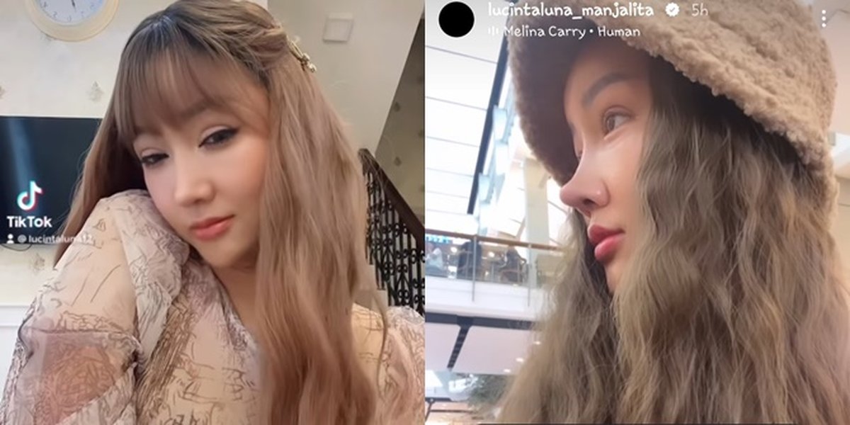 Lucinta Luna Asks Fans for Opinion on Her New Plastic Surgery Face, Resembling Whom, Said to Look Like Korean Eonnie to Muhammad Fatah