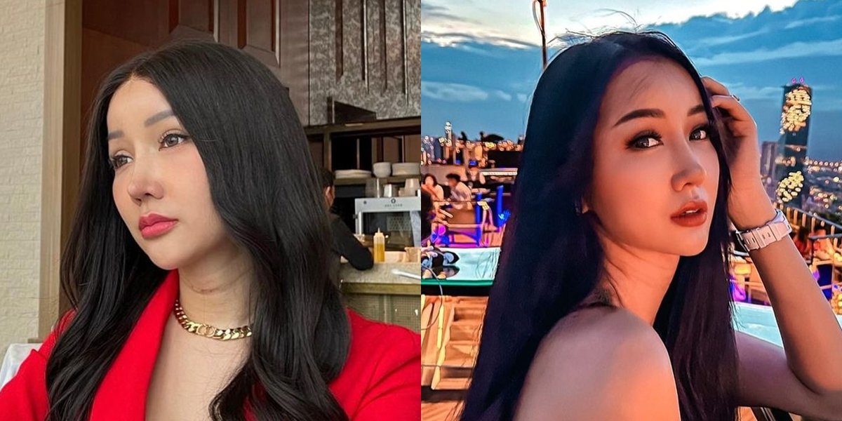 Want to be V BTS's wife, 8 Photos of Lucinta Luna who is Growing More Confident after Plastic Surgery - Now Resembles Jisoo BLACKPINK