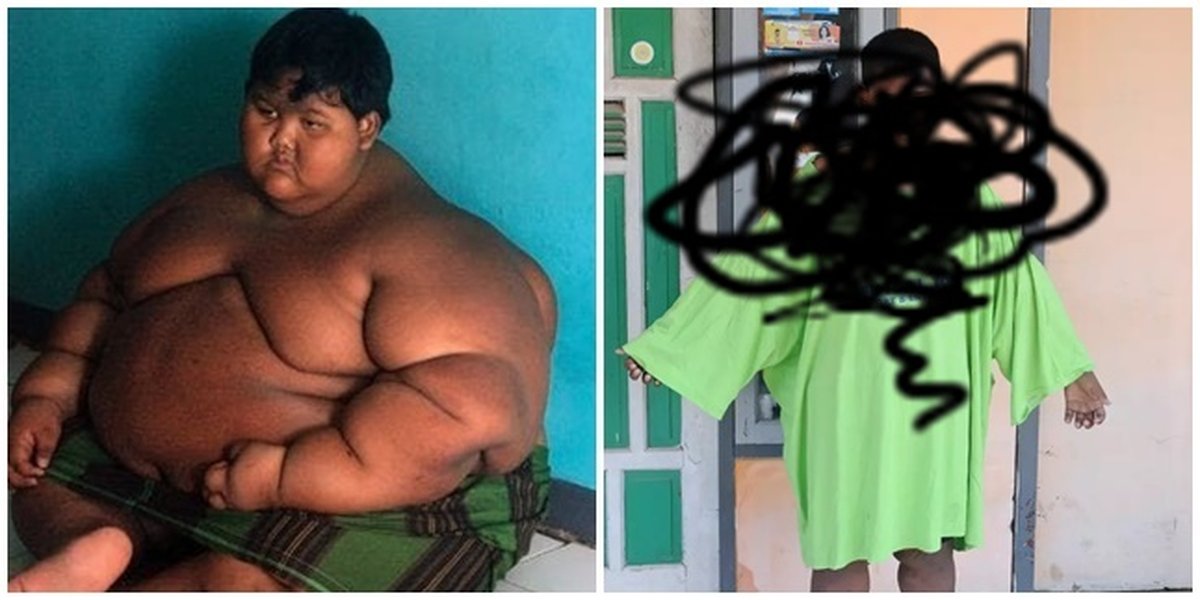 Still Remember 192 Kg Boy Arya Permana? Here's His Current News