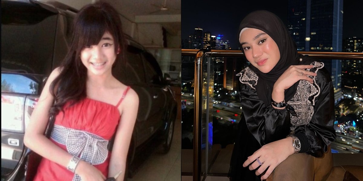 Since 2017 Convert, Here are 10 Photos of Clara Shinta's Transformation, Who Was Once Called a Government Official's Mistress - Beautiful Since Childhood