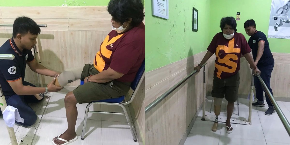 Using Prosthetic Legs, 10 Portraits of Suti Karno After Amputation Due to Diabetes - Now Living a Healthy Lifestyle