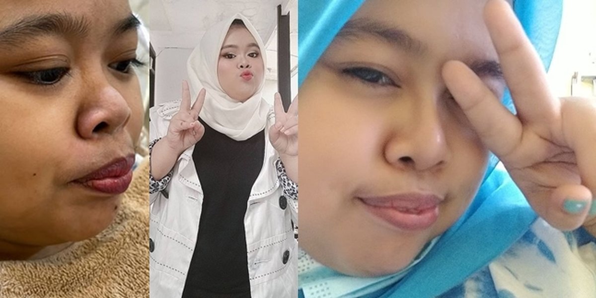 Potrait of Kekeyi Getting a Nose Filler, the Result Makes People Stunned - Flood of Netizen Criticisms