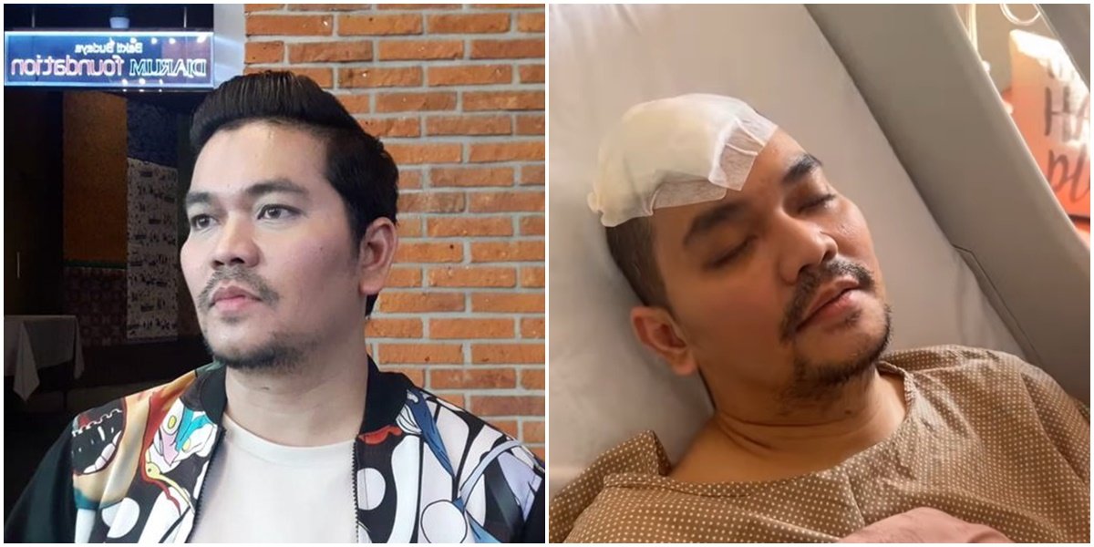 Portrait of Indra Bekti's Condition that is Getting Better from Day to Day, Installed Tubes on the Head - Estimated to be Able to Return Home Next Monday